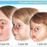 noses_children2